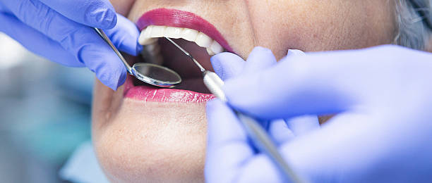 Best Emergency Dentist for Lost Fillings or Crowns in Tigard, OR
